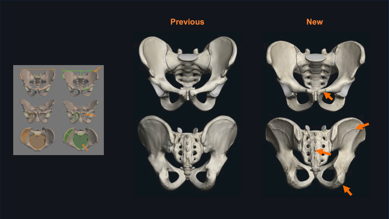 Side by side comparison of the bones of the male pelvis. On the far right is a schematic highlighting the difference in dimensions. In the middle is anterior and posterior views of the previous model. On the left is anterior and posterior views of the updated pelvis.