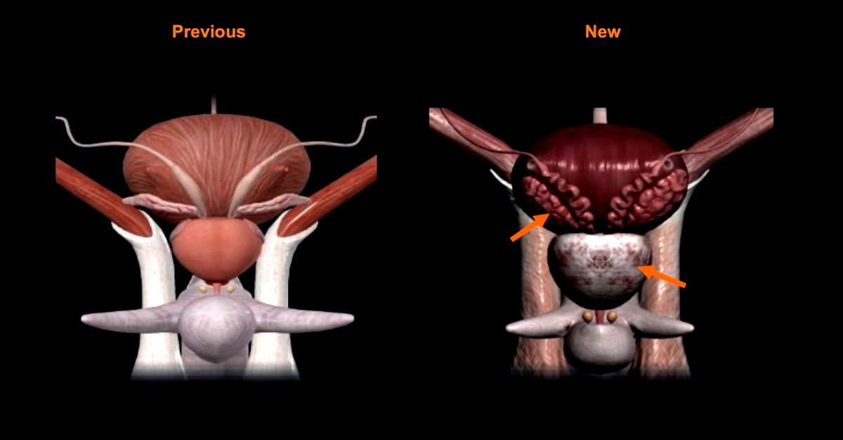 Side by side comparison of posterior view of the bladder, prostate, seminal glands, and ampulla of vas deferens. Left has the previous model and right has the new model. 